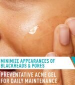 CeraVe Acne Control Gel with 2% Salicylic Acid, AHAs & Ceramides – 40ml