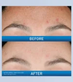 CeraVe Resurfacing Retinol Serum – 30ml